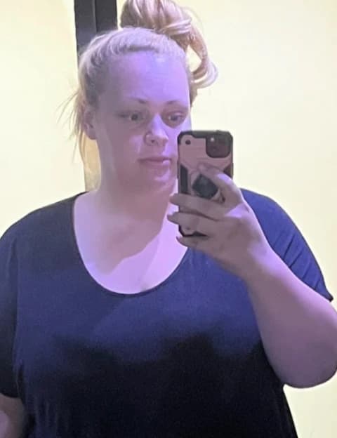 Camilla - przed leczeniem