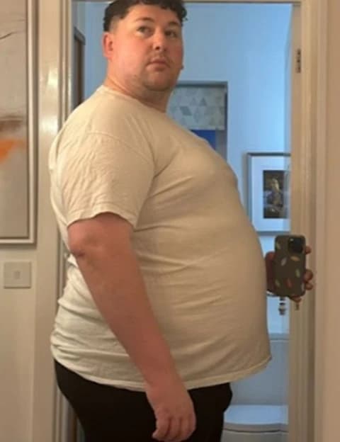 Stephen - przed leczeniem